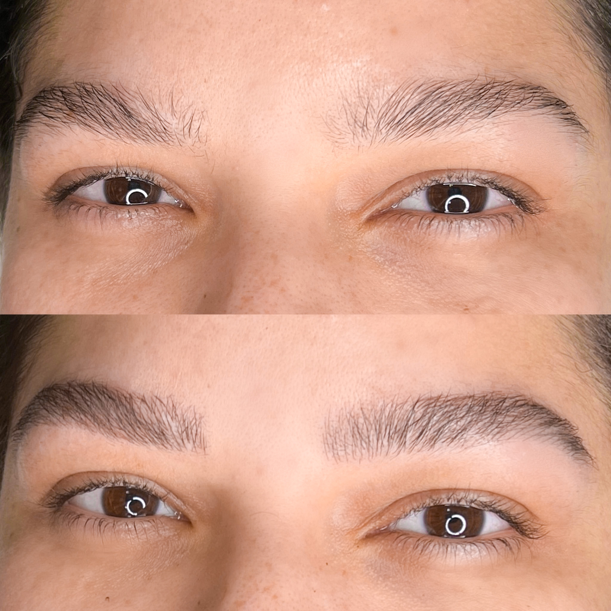 Antes e depois 2