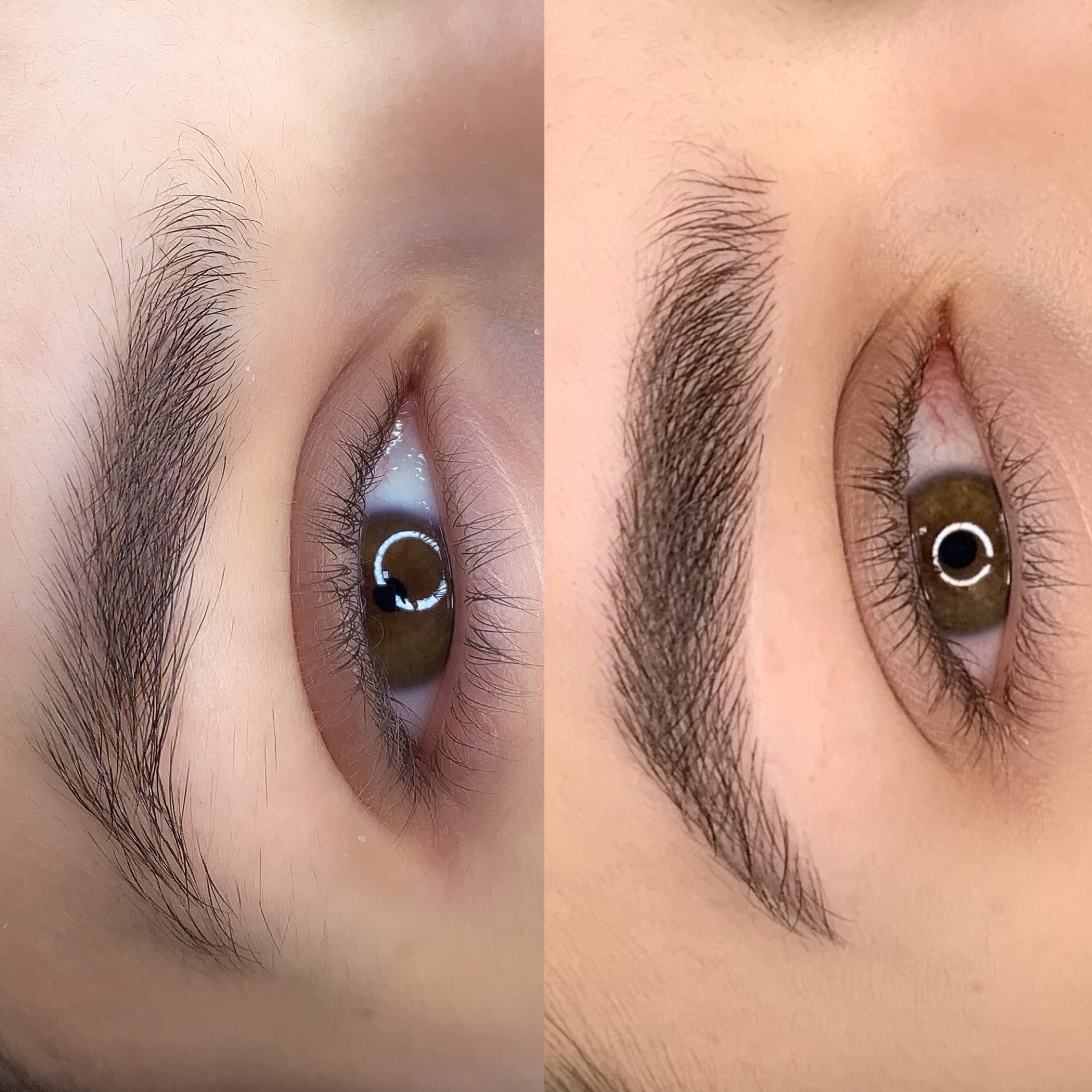 Antes e depois 3